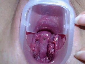 Teenage Showing Her Cervix With Deep And Close-up Exploration. Teenage Shows Her Pussy In From Of A Camera With Close-up Scene Of Cervix By Means Of Speculum To Provide Really And Deep Presentation Porn