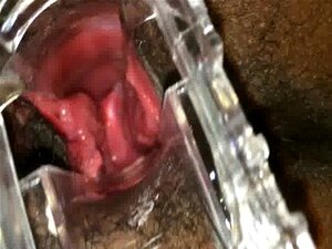 Black Female Shows Her Cervix With A Speculum Part 2 Porn