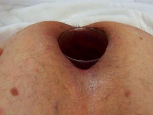 Prolapse Insertion Gaping Fist Ass Anal Arse Huge Dildo